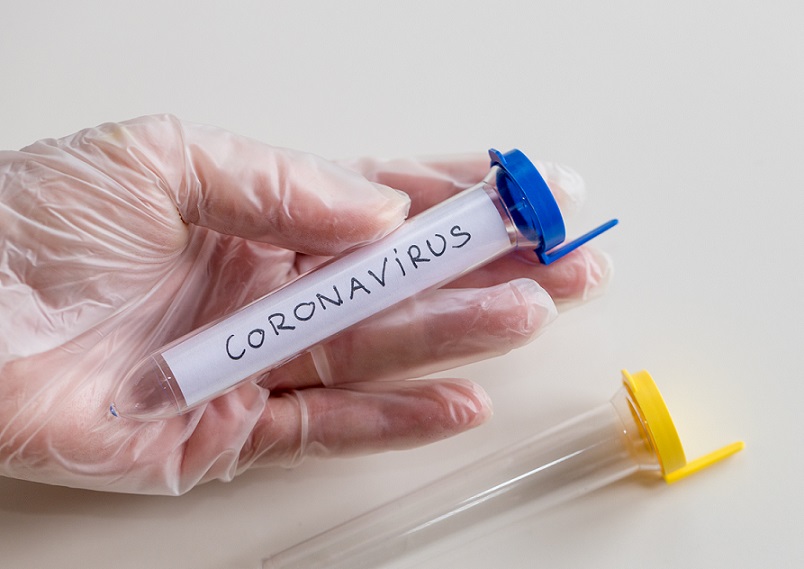 Is your business affected by the coronavirus and will your insurance policy respond?